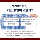 서초수비뇨기과의원 | 강남 서초구비뇨기과 의원 팽창형보형물 수술?