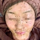 건강한 약초 | 약초필링 후기 내돈내산 고통받은 후기 ㅠㅋ