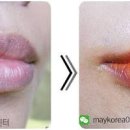 입술색 상태로 보는 건강 체크하는 법 이미지