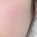 인셀덤바름