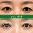 아이케이성형외과의원 네이버블로그