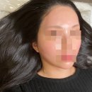 분당 왁싱 빛나도다 : 좁은 이마 고민 끝! 분당 미금왁싱 10년 베테랑에게 받은 페이스 윤곽 후기