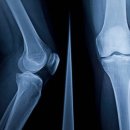 이정형외과의원 이미지