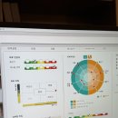 서울더빛의원 | [을지로피부과] 리나인의원 | 리쥬란 첫 시술 내돈내산 후기