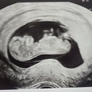 태명산내과의원 | [임신 11주차0일] 동탄역 헤스티아 의원 초음파 후기_남편일기