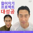 잉크본 이미지