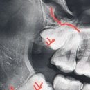 일산진사랑니치과의원 이미지