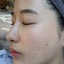 담양 피부관리 <로이뷰티> esv10 모공디톡스 후기| 담양피부관리• 바디케어