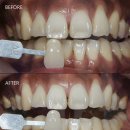 서울언제나치과의원 이미지