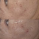천안 미백관리 두정동 &#39;미작뷰티&#39; 후기