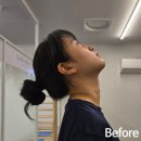 역삼로 | 강남체형교정 클래스바디, 목어깨 통증 풀어준 대치동필라테스 찐만족