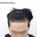 라인컷