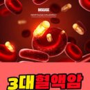 혈액암 초기증상 림프종 혈액암 원인 이미지