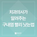 이편한장치과의원 | 잘 모르는 진짜 구내염 원인, 강남 치과의사가 알려주는 구내염 빨리 낫는법
