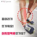 종아리 뜨거운 느낌!! 열감의 원인은? 이미지