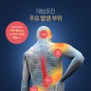 질병 "대상포진 Herpes zoster" 이미지