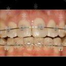 내곡웰치과의원 이미지