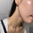 화사뷰티 | 강릉피부관리 화사한뷰티어겐 붉은 얼굴 관리 만족 후기
