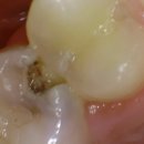 이(e)-밝은치과의원 이미지