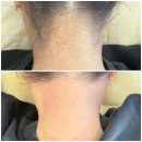 투쓰리 헤어라인 | 본오동왁싱 묶을 때 라인 달라지는 뒷목 헤어라인 왁싱 후기 I 투네일앰 I