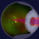 바른안과 이미지