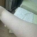 다이안 | LPG 엔더몰로지 알리앙스 리얼 찐 효과 리뷰 후기[ 홍대 다이어트 다이안 테라피]