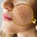 우리피부 이미지