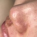 준메디텍 | 여주 피부 관리는 여기서! 메디스킨 유리하 후기