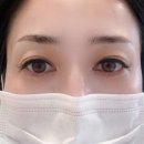 세미도서관 3층 | 서면눈썹 잘하는 ON하루 뷰티 부산잔흔제거 후기