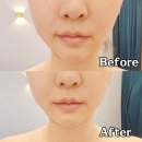 쿠잉 | 김포 피부관리 하성 쿠잉뷰티 코네오테라피 후기