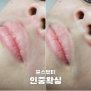 뚠스뷰티 네이버블로그