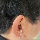 스타키보청기 | 전주벨톤보청기, 🌿 70대 여성, 스타키 엣지 보청기 사용 후기