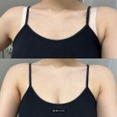 모아보아 | 접착력 좋은 웨딩드레스 누브라 추천 메보아 사용 후기