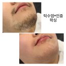 ♦️평택역 왁싱♦️ 프라이빗하고 꼼꼼한 디디뷰티 왁싱후기😄