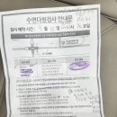 양지-9 | 무턱 양악 수술 #24 수면다원검사/후기/비용_신림 양지병원