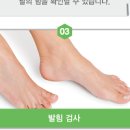 루게릭병 초기 원인 진단 (근위축성측색경화증, ALS) 이미지