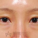 쌍수인