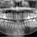 더바른윤치과의원 이미지