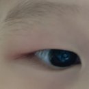 참밝은안과의원 이미지