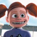 월비농장 | 교정 곧 끝나가는 사람이 쓰는 교정후기(단점편)