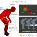 자료 [파킨슨 병] 이미지