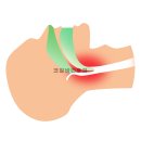 코알이비인후과의원 | 세종시코골이수술 전에 확인해봐야 할 사항 &lt;확인&gt;