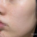 김정문알로에피부샾 | 다이소 신상 김정문 큐어알파 알로에 하이드로겔 마스크팩 민감성피부 사용후기