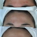 자체관리 | 나만 몰랐던 피부 찐템 발견! 충주피부관리 갓벽 그 자체 후기