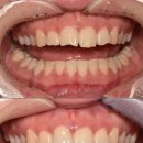 바르게치과의원 | 울산신정동치과, "정말 다 치료해야 하나요?"라는 의문이 남으셨다면 <주목>