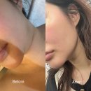 유포리아컨설팅 | 서귀포윤곽관리 마이에스테틱 플라모드 효과후기