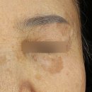 에이봄의원 이미지