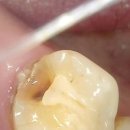 서울상아치과의원 이미지