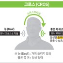 참소리보청기 이미지