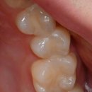 의정부본플란트치과의원 이미지